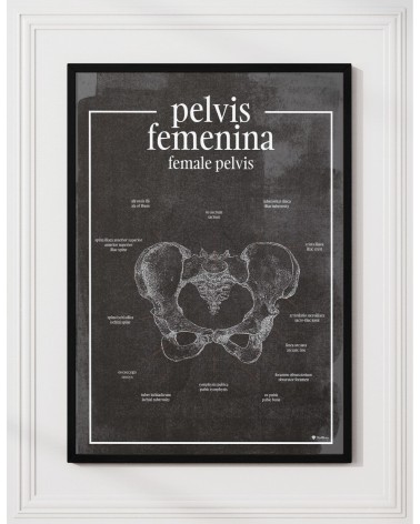 Miednica Żeńska - Plakat Anatomiczny - chalkboard